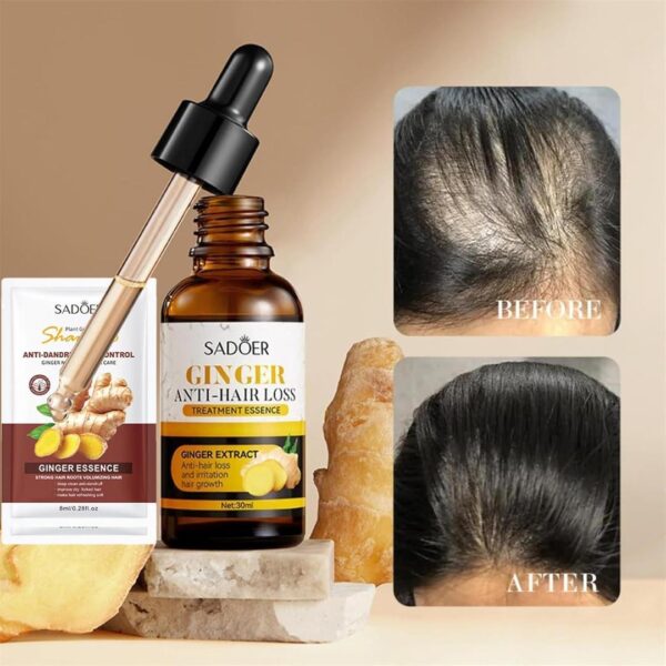 Ginger Anti-Loss Hair Serum With Ginger Extract 30ml - Image 2