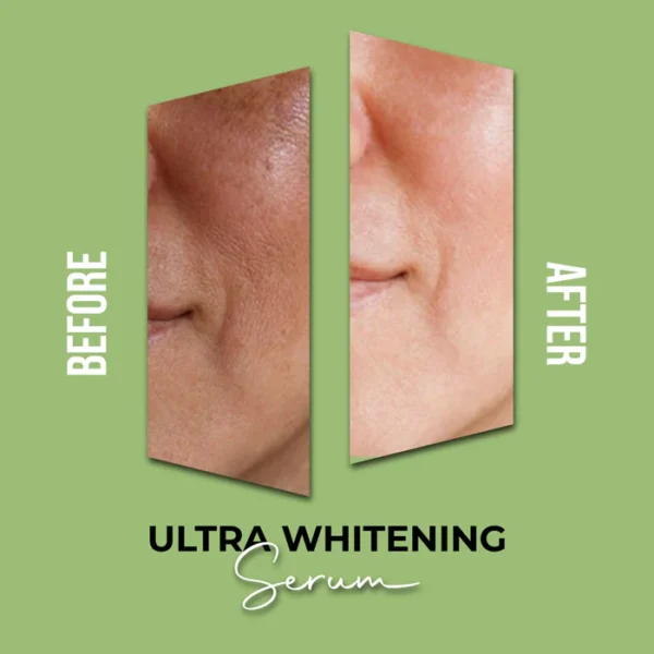 Ulta Whitening Serum - Image 2